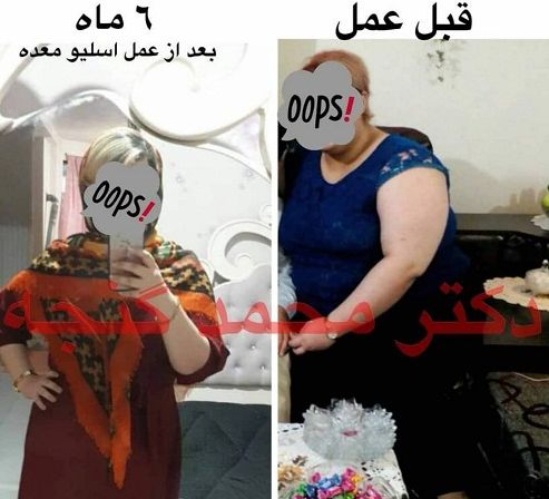 بهترین جراح چاقی و بای پس تهران