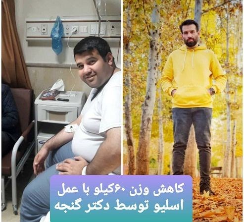 بهترین جراح چاقی و بای پس تهران